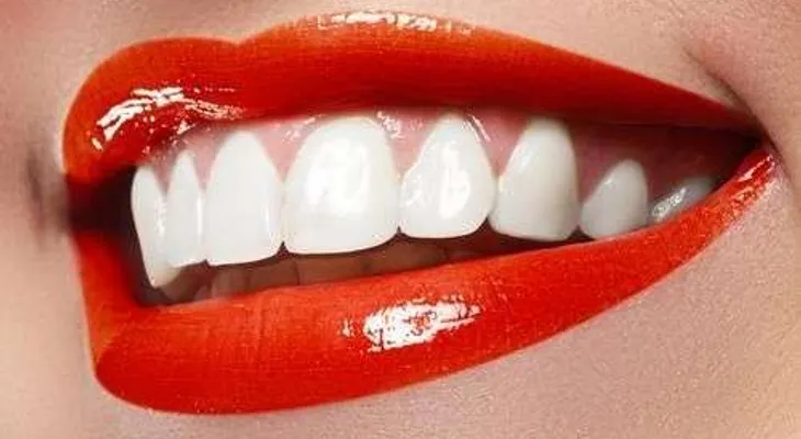 4 reglas de oro para evitar que el herpes labial se forme