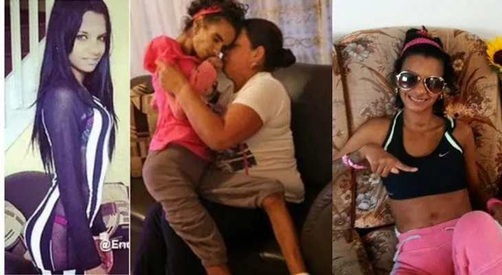 Evolución de la joven que quedó parapléjica por implante de seno