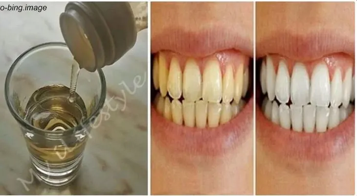 Esta es la única receta para eliminar el sarro dental
