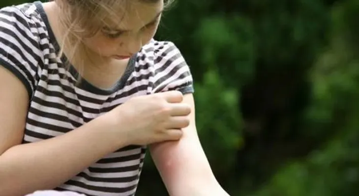¿Por qué te pican los mosquitos más que a nadie?