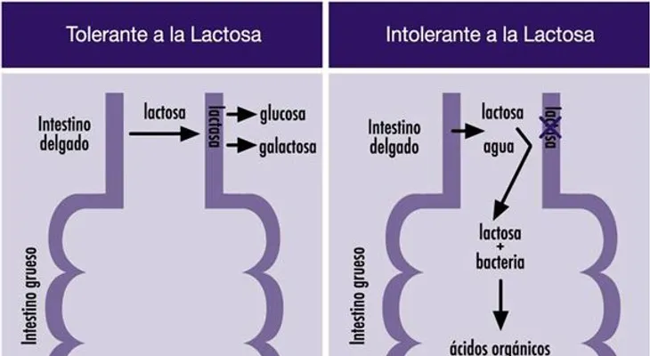  Señales de intolerancia hacia la lactosa 