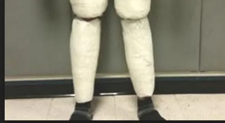 Dominicano Juan Carlos Galán tenía 10 libras de cocaína pegadas a sus muslos y pantorrillas