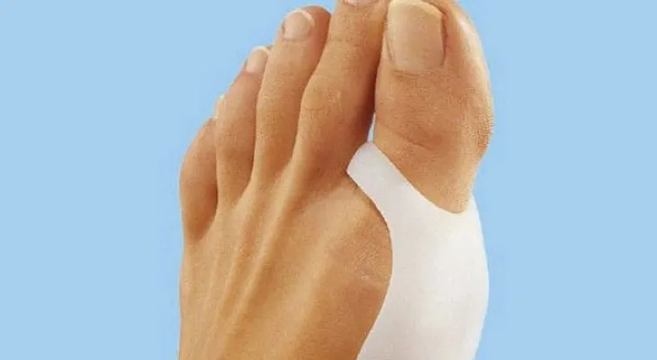 7 cuidados básicos para tus pies si tienes juanetes