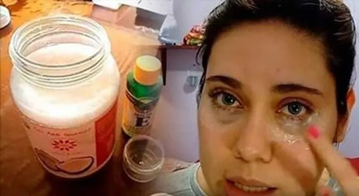 Termina con las arrugas de los ojos con esta crema casera. Se prepara con pocos ingredientes.