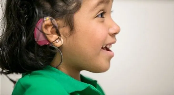 Prueban implante para ayudar a niños con sordera 