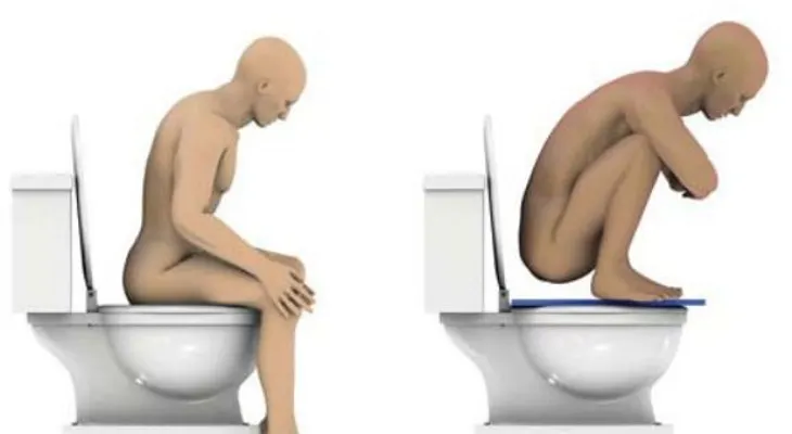 ¿Vas correctamente al baño? Conoce la postura para sentarse