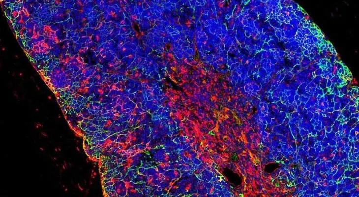  Generan leucemia de linfocitos T "in vivo" a partir de una célula sana 