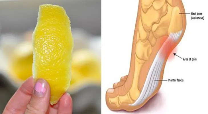 Truco con la cascara de un limón para deshacerse de la inflamación y el dolor crónico!!!
