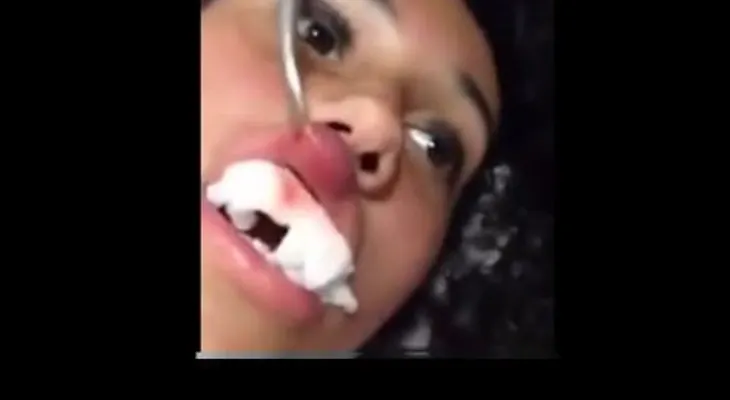 Fue al médico por una hinchazón en el labio...y le sacan algo increíble (VIDEO)