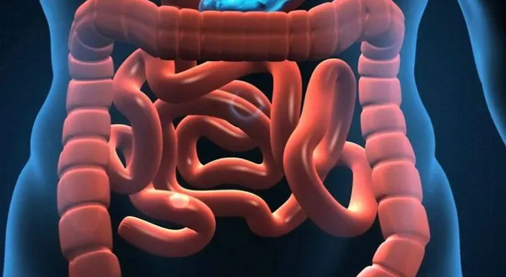  Expertos avanzan en tratamientos para el "síndrome del intestino corto" 