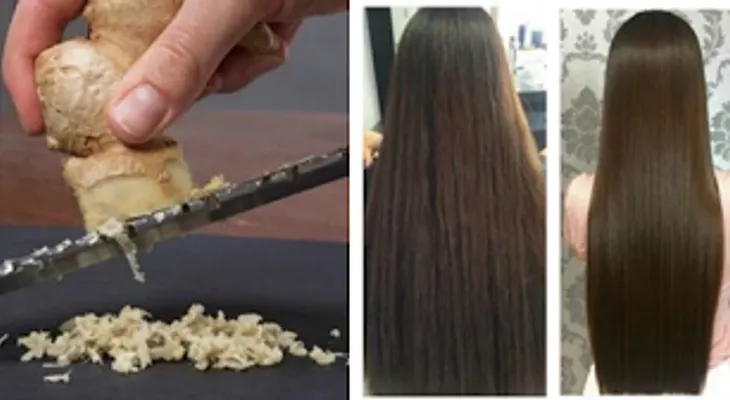 Un remedio que dejará tu cabello 100% libre de caspa y crecerá sin PARAR 