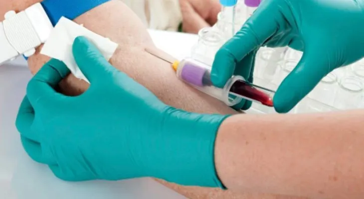Análisis de sangre detectaría alzhéimer hasta 20 años antes de su aparición