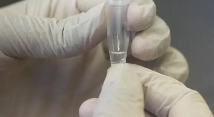 El suero equino, la nueva esperanza Argentina contra el coronavirus