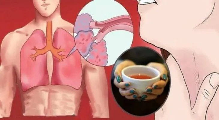 Infusión para expulsar por completo las flemas de los pulmones y cura el asma de manera natural