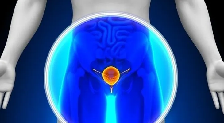 Si siente uno de estos síntomas podría estar sufriendo de cáncer de vejiga