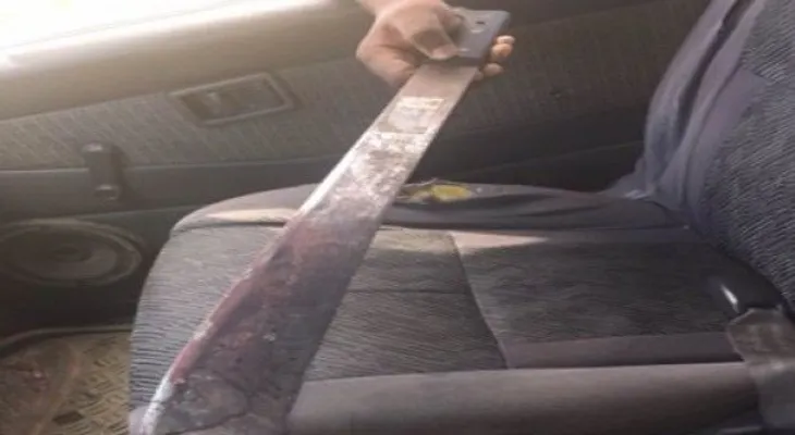 Crueldad: Mujer quema a un hijo con un machete caliente en Montecristi