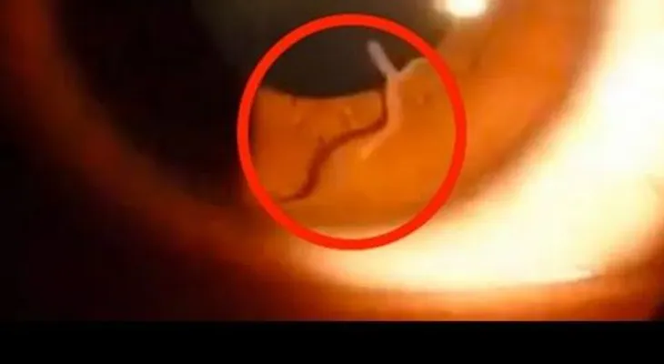 Doctor mira el interior  ojo de mujer y descubre algo que está causando asombro (VIDEO)