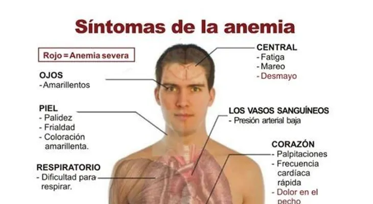 Alarmante: El 61 por ciento niños de seis a once meses tiene anemia en RD; y el 34 por ciento de las mujeres