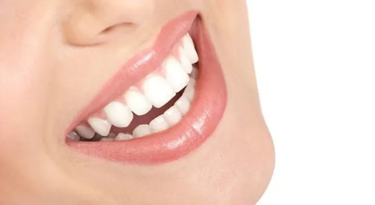 10 mitos y verdades del blanqueamiento dental