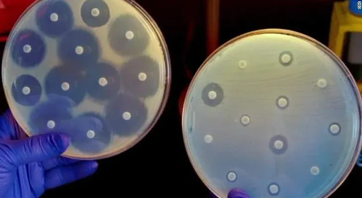 La superbacteria resistente a los antibióticos que preocupa a Estados Unidos