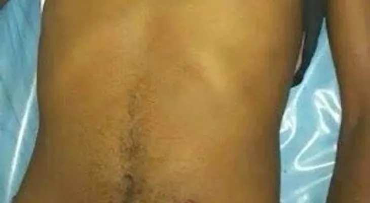 3 muertos y 4 heridos en tiroteo en Puerto Plata