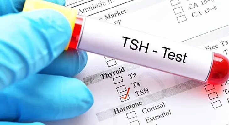 Hipotiroidismo subclínico: no prescribir hormonas de forma rutinaria