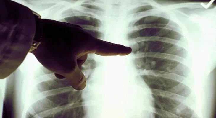 Un estudio revelará claves de la incidencia del cáncer entre hispanos de EEUU