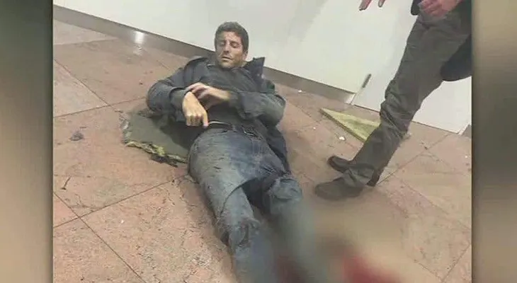Sobreviviente de ataque en Bruselas: 'perdí parte de mi cadera'