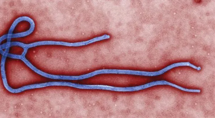 El ébola sigue imparable y el mundo busca controlar letal enfermedad