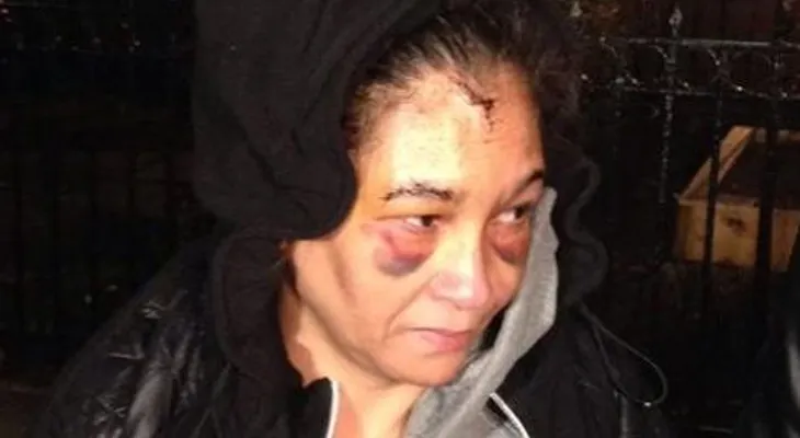 Presunto violador propina golpiza a dominicana