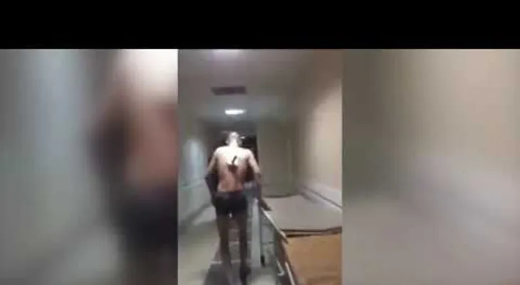 Se fuga de un hospital con un cuchillo clavado en la espalda, para fumar 