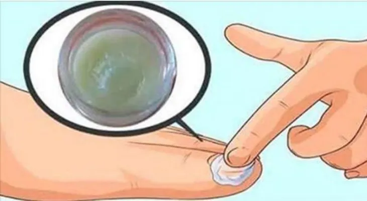El "rompe hongos" que elimina todos los hongos de las uñas