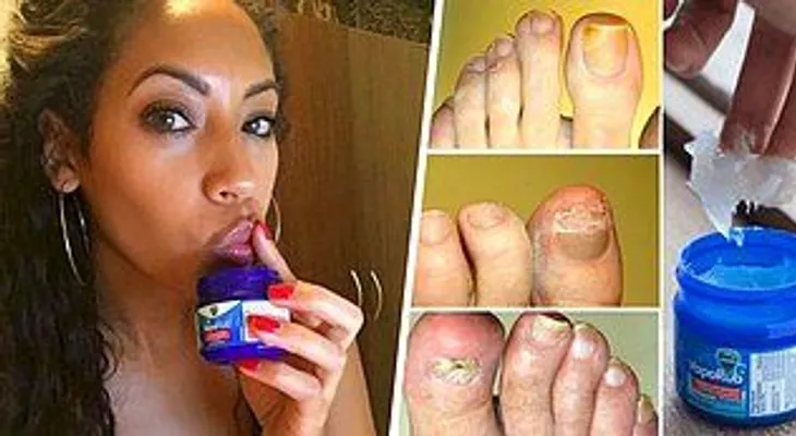 13 usos increíbles del VICKS VAPORUB que ni los médicos pueden explicar...