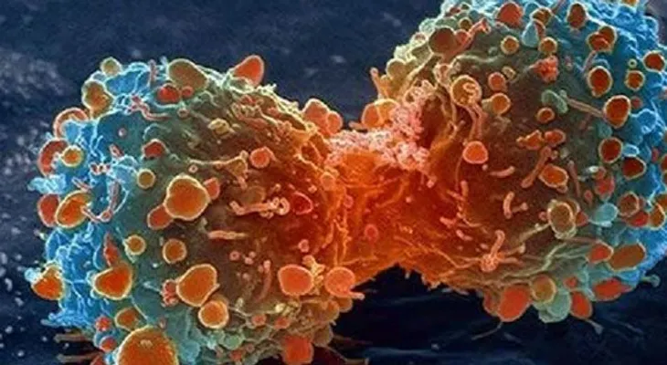 La cura contra el cáncer sale a la luz: Descubre el secreto 