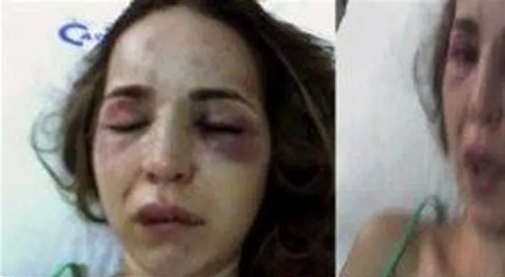 República Dominicana encabeza índice femicidios AL y El Caribe