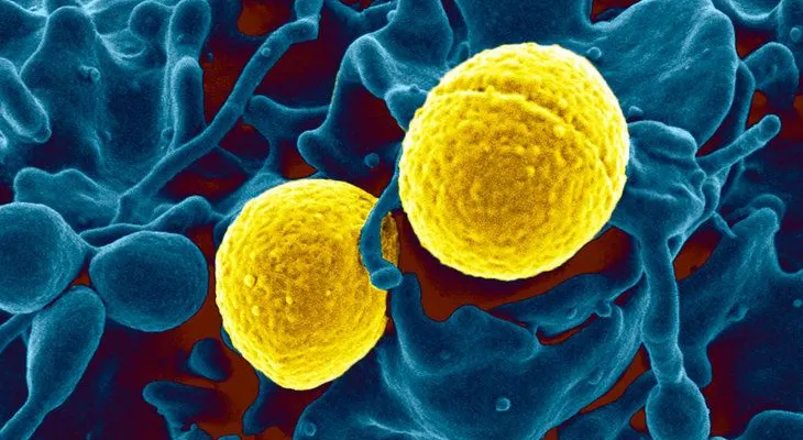Microorganismos resistentes a antibióticos aumentaron en la última década
