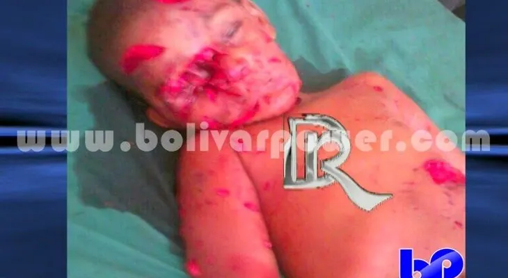 Perros "pitbull" matan niño de 3 años en Samaná