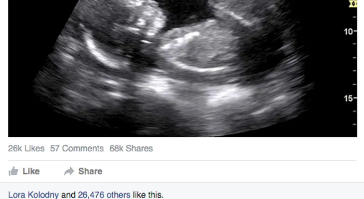 Cansada de la pregunta: ¿Por qué no tienes hijos? tienes que leer lo que publicó en Facebook