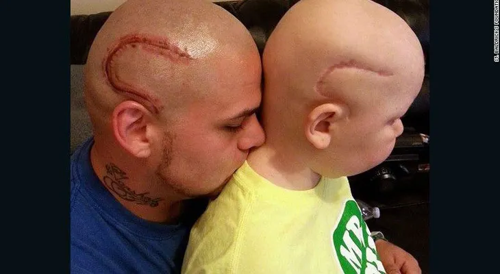 Niño con tumor cerebral ayuda a su padre a lidiar con el dolor
