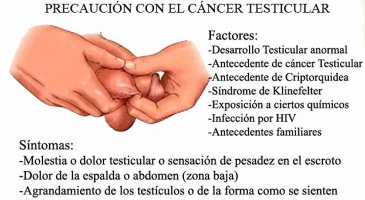 ¿Los hombres con cáncer de testículo pueden engendrar hijos?