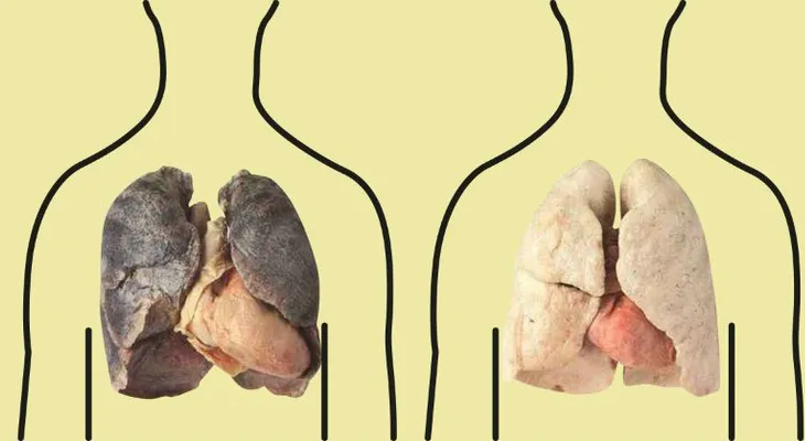 4 productos que purifican los pulmones de un fumador.