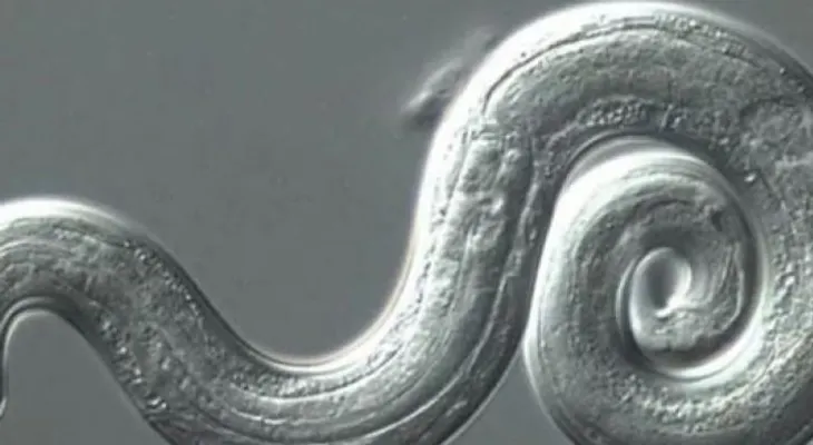 Parásito letal que ataca al cerebro humano se extiende por EEUU