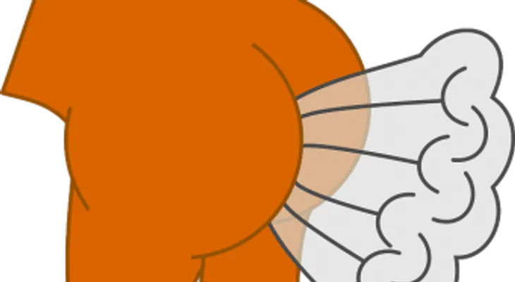 El exceso de flatulencia podría ser síntoma de una enfermedad 