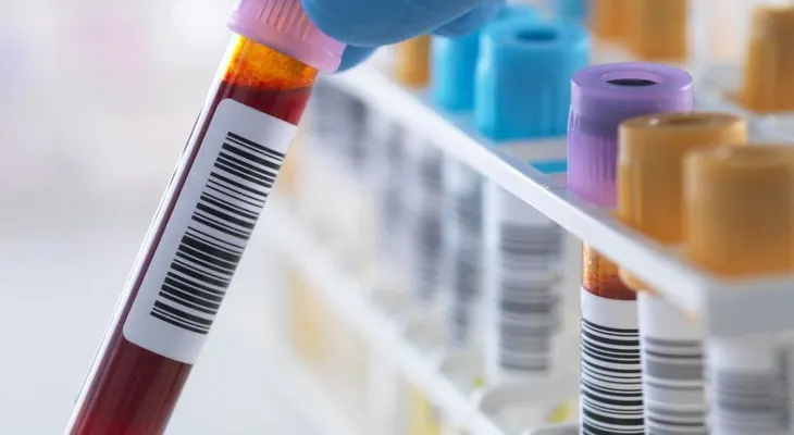 Inyectan 3,1 millones para diagnosticar el Alzheimer con análisis de sangre