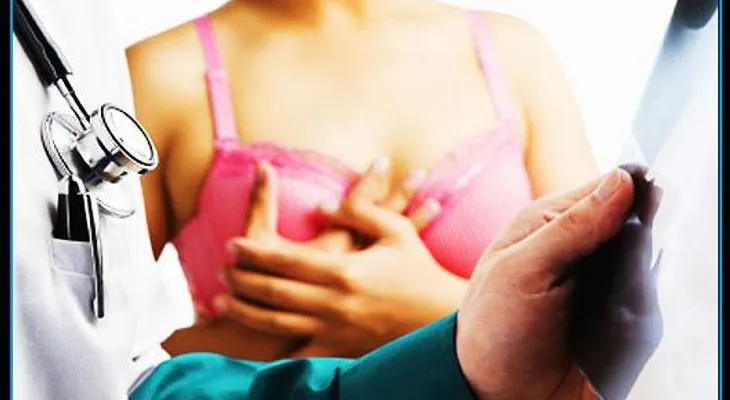 10 formas de prevenir el cáncer de mama