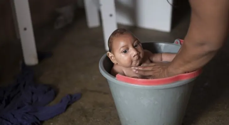 Mueren en Brasil 5 bebés con malformación causada por el zika