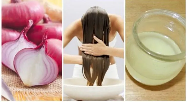 "Secretos Revelados: Detén la Caída del Cabello de Forma Sorprendente con la Poderosa Fusión de Cebolla y Ron"