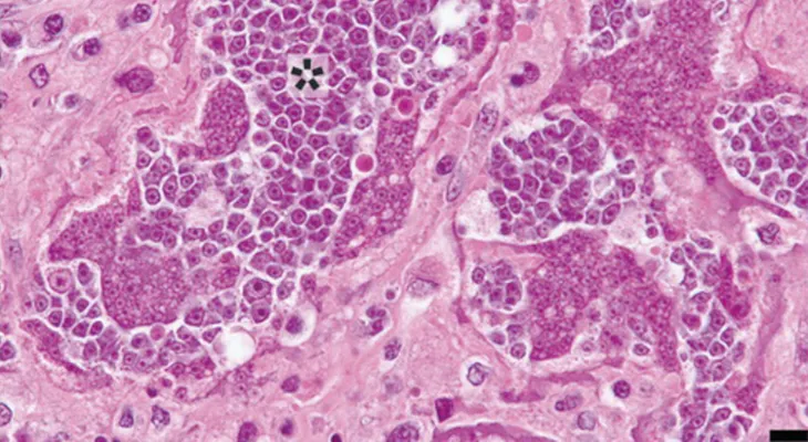 Cáncer contagiado por parásito es un caso excepcional, dice médico que atendió a paciente