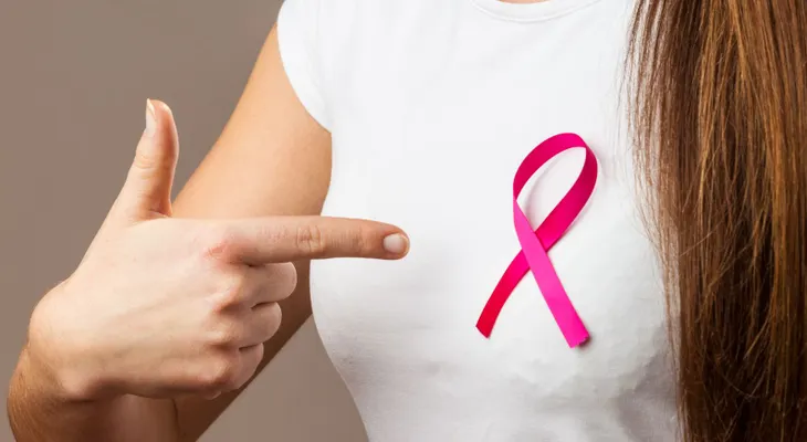 El gen BRCA no influye en la probabilidad de supervivencia al cáncer de mama 