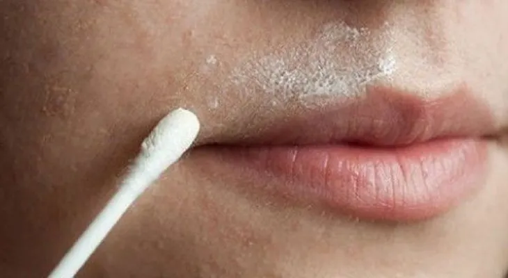 Remedios y trucos para eliminar el vello facial